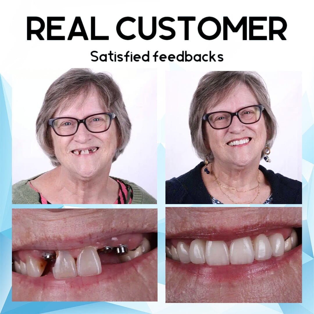 Furzero™ Silicone Reline Denture Set🦷