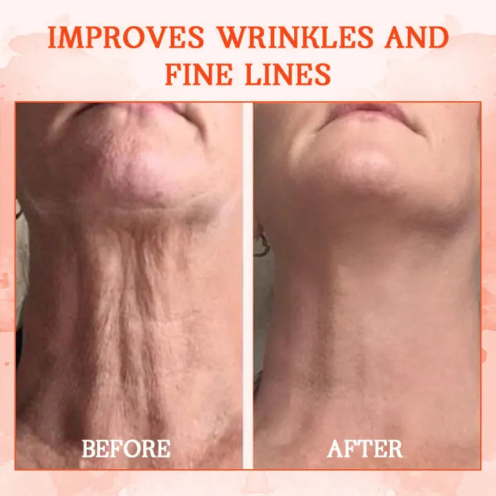 ๐ท๐ง๐๐๐ฌ๐ญ ๐๐๐ฒ ๐๐ข๐ฌ๐๐จ๐ฎ๐ง๐ญ: ๐๐% ๐๐
๐
Furzeroยฎ SkinFirming Rejuvenating Cream