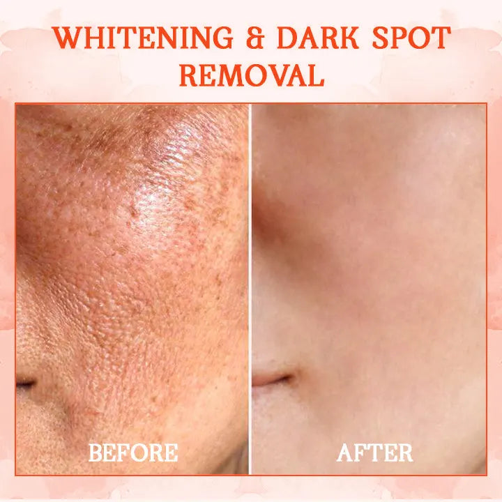 ๐ท๐ง๐๐๐ฌ๐ญ ๐๐๐ฒ ๐๐ข๐ฌ๐๐จ๐ฎ๐ง๐ญ: ๐๐% ๐๐
๐
Furzeroยฎ SkinFirming Rejuvenating Cream