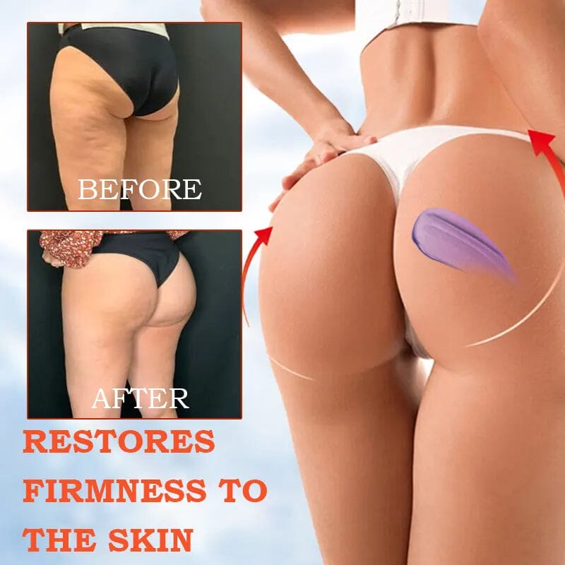 ๐ท๐ง๐๐๐ฌ๐ญ ๐๐๐ฒ ๐๐ข๐ฌ๐๐จ๐ฎ๐ง๐ญ: ๐๐% ๐๐
๐
Furzeroยฎ SkinFirming Rejuvenating Cream