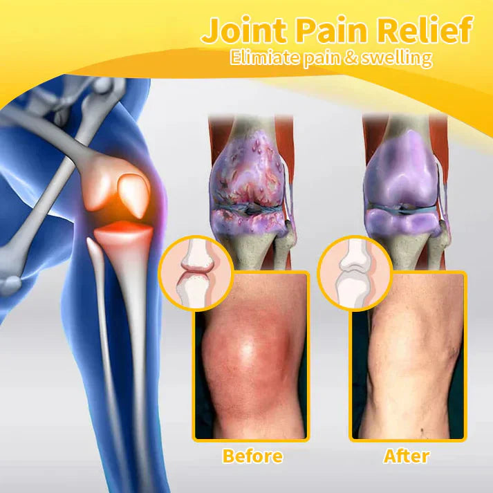 ✅Official Store: flysmus™ Bee-Venom Pain-Relief Bone Healing Cream👨⚕️UK Osteopathic Medical Association (BOA)Approved(Reducing joint swelling, pain, stiffness, redness, warmth, soreness, and joint fatigue)