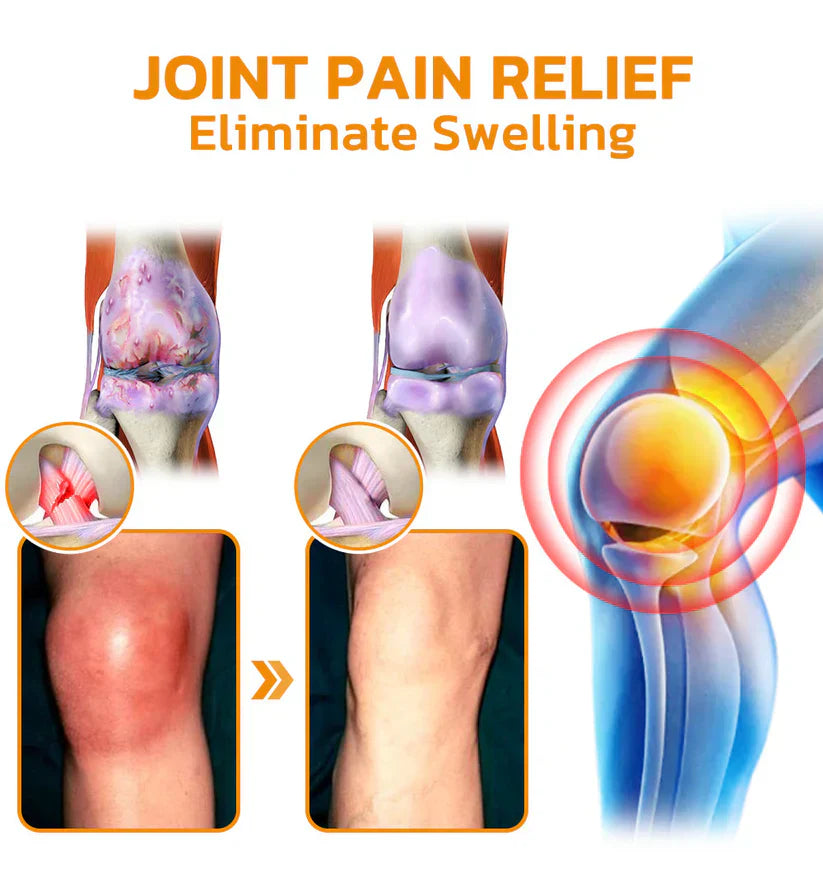 ✅Official Store: flysmus™ Bee-Venom Pain-Relief Bone Healing Cream👨⚕️UK Osteopathic Medical Association (BOA)Approved(Reducing joint swelling, pain, stiffness, redness, warmth, soreness, and joint fatigue)