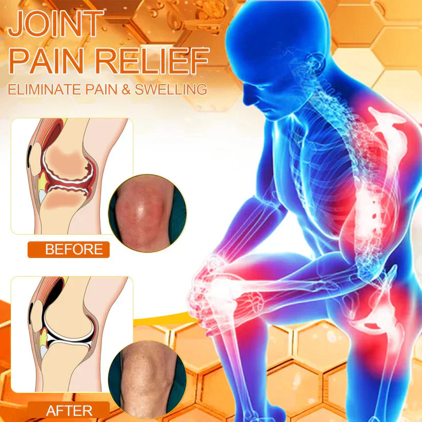 ✅Official Store: flysmus™ Bee-Venom Pain-Relief Bone Healing Cream👨⚕️UK Osteopathic Medical Association (BOA)Approved(Reducing joint swelling, pain, stiffness, redness, warmth, soreness, and joint fatigue)