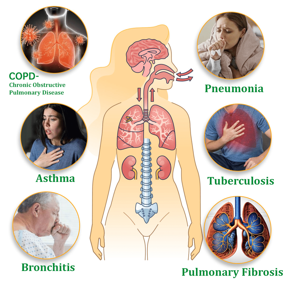 💜✅Official Store:Ourlyard® Herbal Lung Cleansing Inhaler👨⚕️FDA Certification(💝 Cough, wheezing, shortness of breath, sputum, stuffy nose, bronchitis, bronchitis, allergy symptoms, lung discomfort💝)