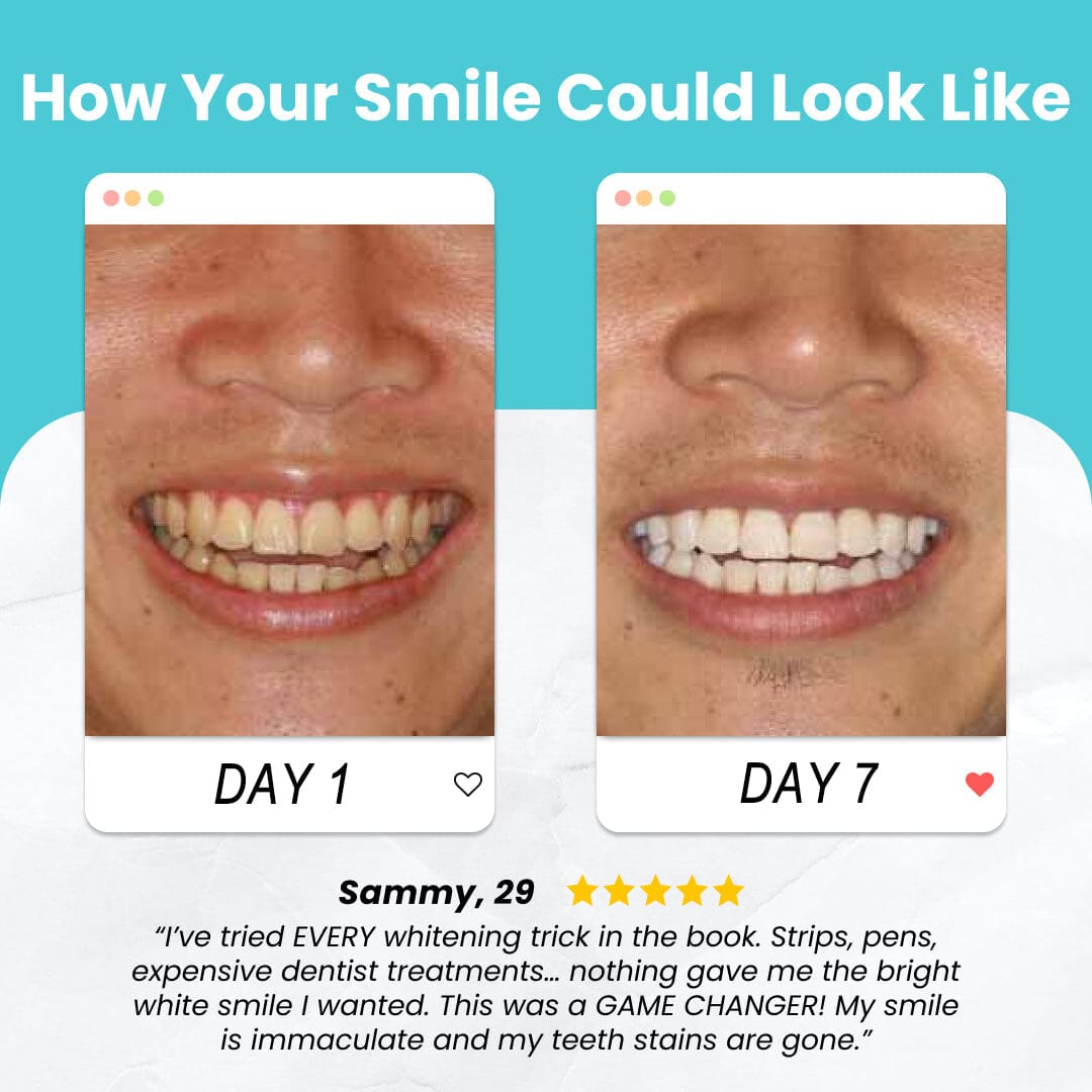 Remifa⢠SpeedySmile EZBrush 360 U-Shape Toothbrush