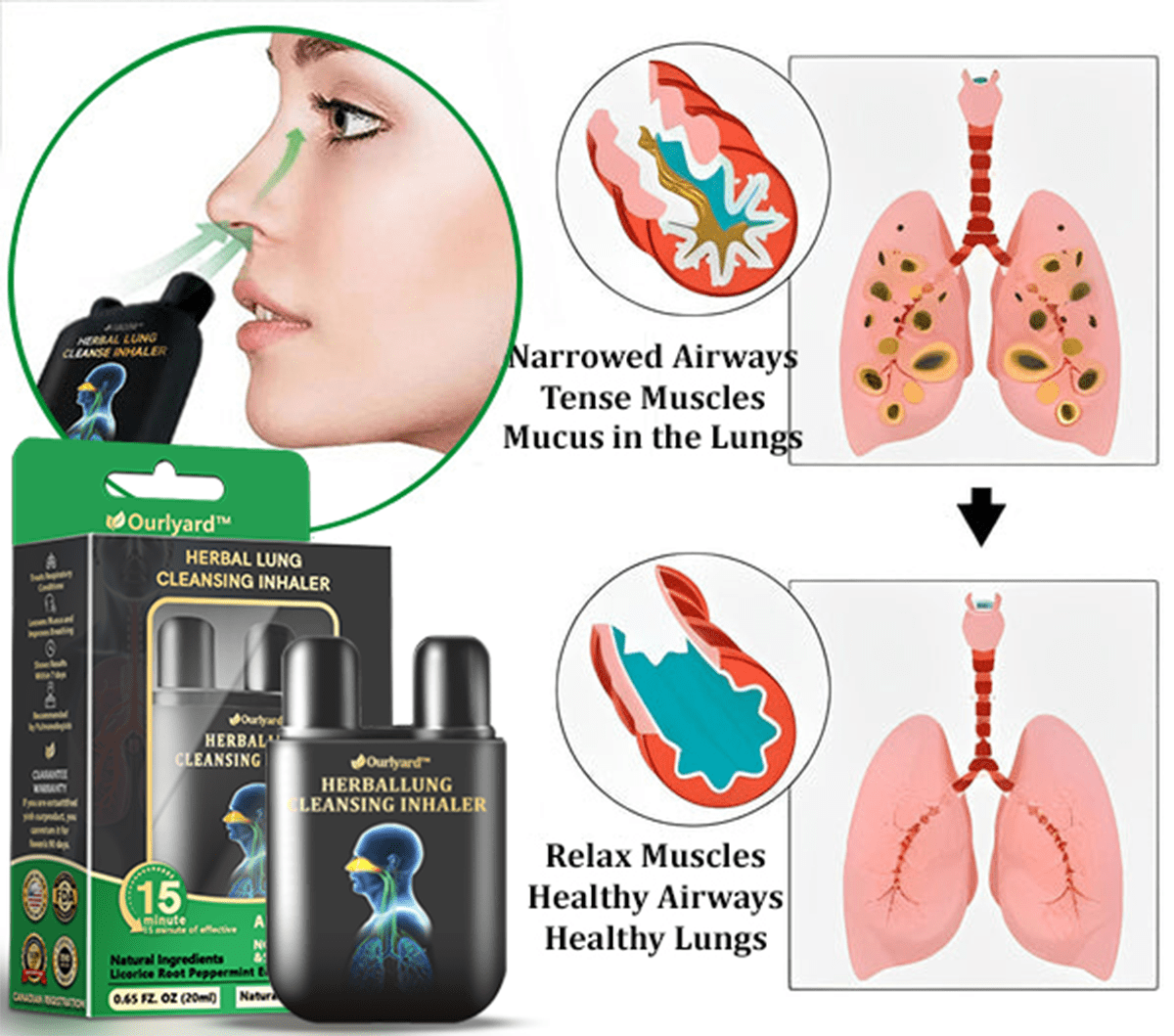 💜✅Official Store:Ourlyard® Herbal Lung Cleansing Inhaler👨⚕️FDA Certification(💝 Cough, wheezing, shortness of breath, sputum, stuffy nose, bronchitis, bronchitis, allergy symptoms, lung discomfort💝)
