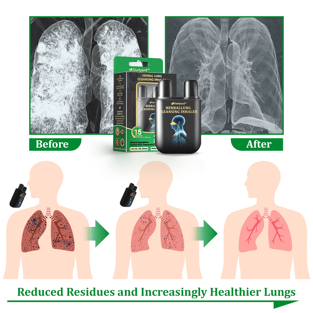 💜✅Official Store:Ourlyard® Herbal Lung Cleansing Inhaler👨⚕️FDA Certification(💝 Cough, wheezing, shortness of breath, sputum, stuffy nose, bronchitis, bronchitis, allergy symptoms, lung discomfort💝)