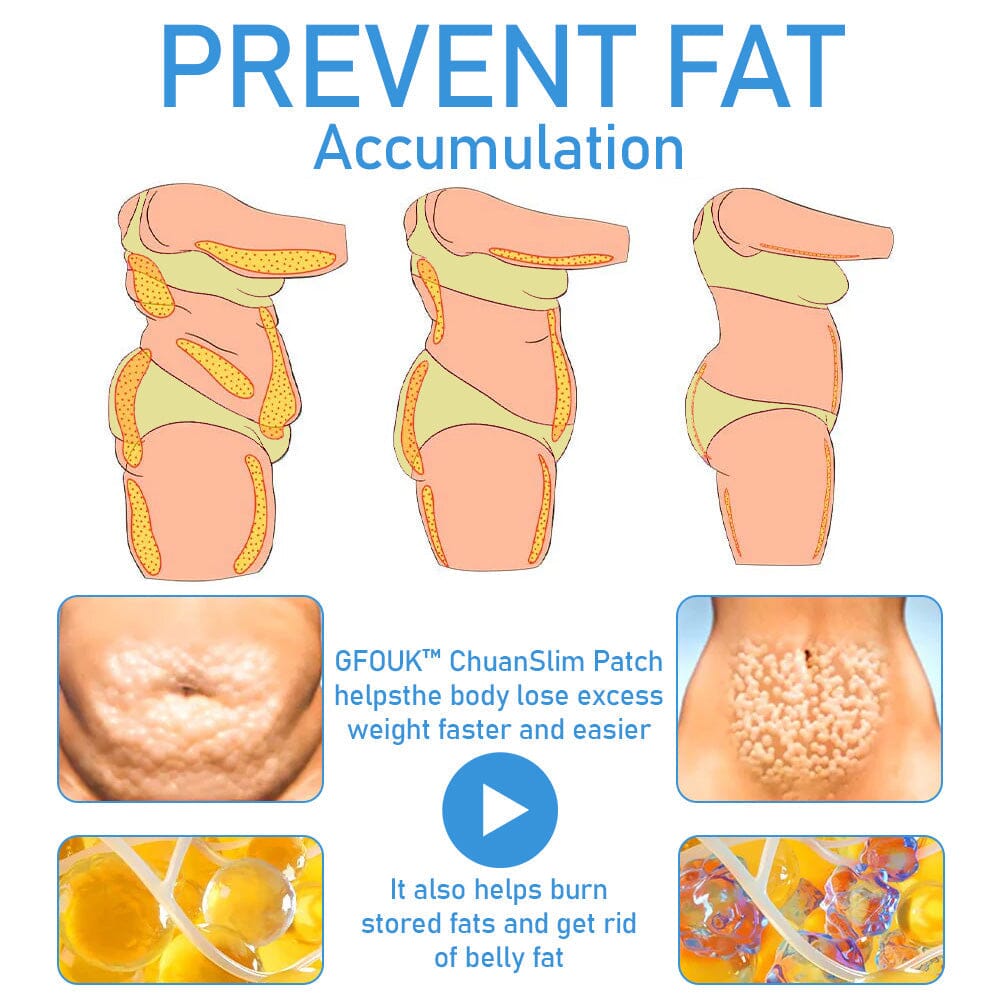 GFOUK™ ChuanSlim Patch