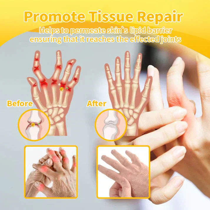 ✅Official Store: flysmus™ Lidocaine Scar-Free Pain Relief Healing Liquid👨⚕️USA Osteopathic Medical Association (AAOS)Approved(Reducing joint swelling, pain, stiffness, redness, warmth, soreness, joint fatigue and remove scars)