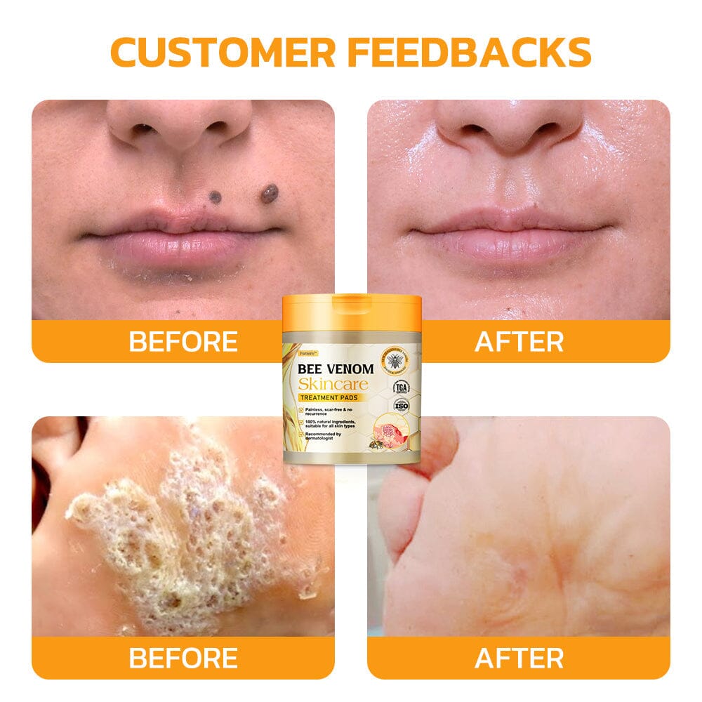 Therapeutic Products Directorate (TPD)✅ Furzero™ Bee Venom Skincare Treatment Pads (⚕️AAD Recommended)