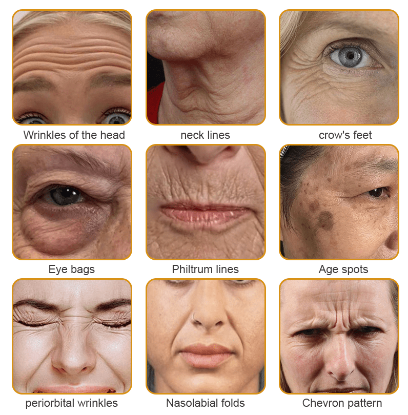 🐝👩⚕️Made and Shipped from USA✨Furzero™ Botox Bee Venom Wrinkle Removal Cream-🔥LAST DAY 70% OFF