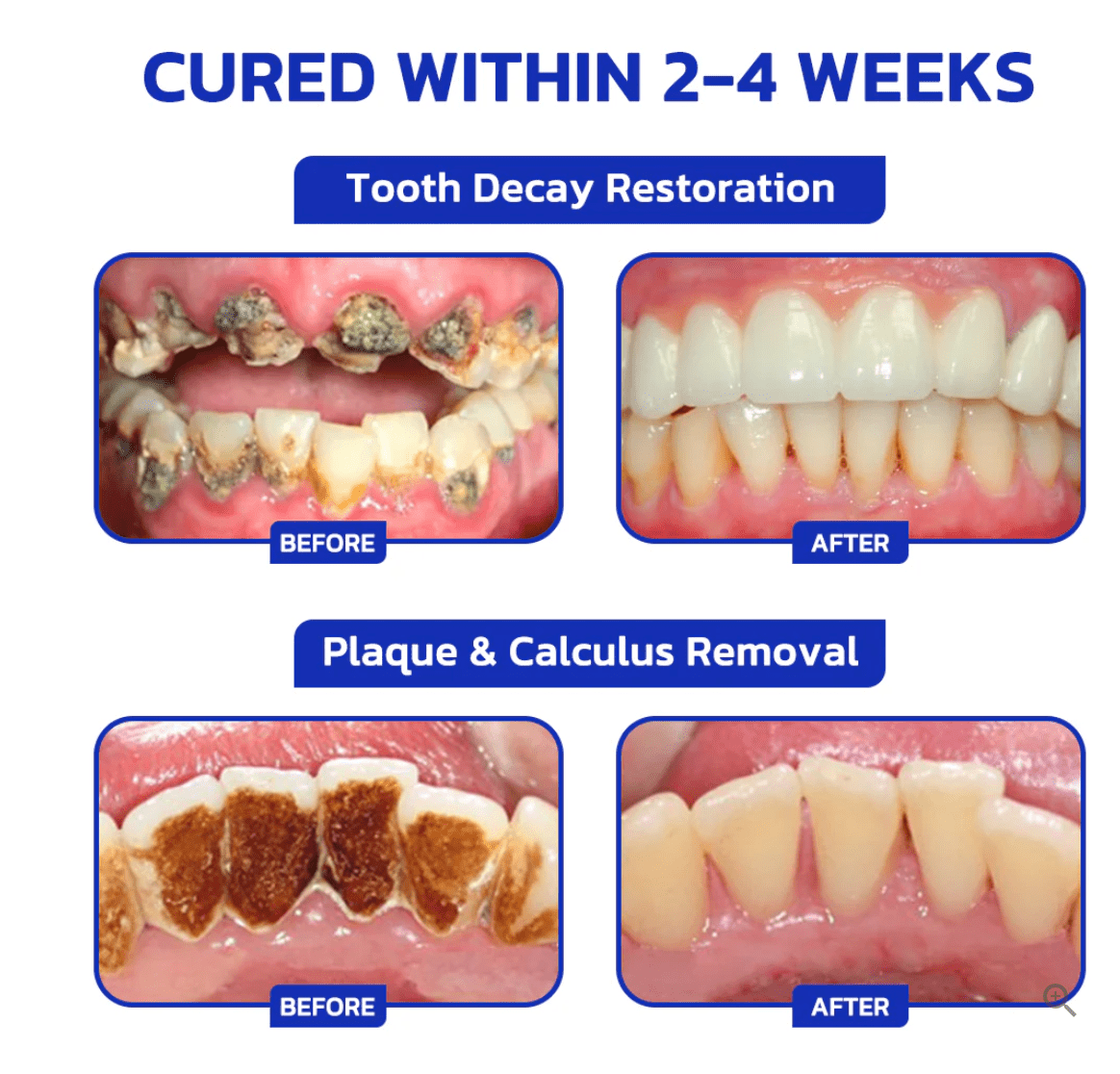 🇺🇸🦷 Furzero™ Focussmile Bee Venom Treatment Oral Powder