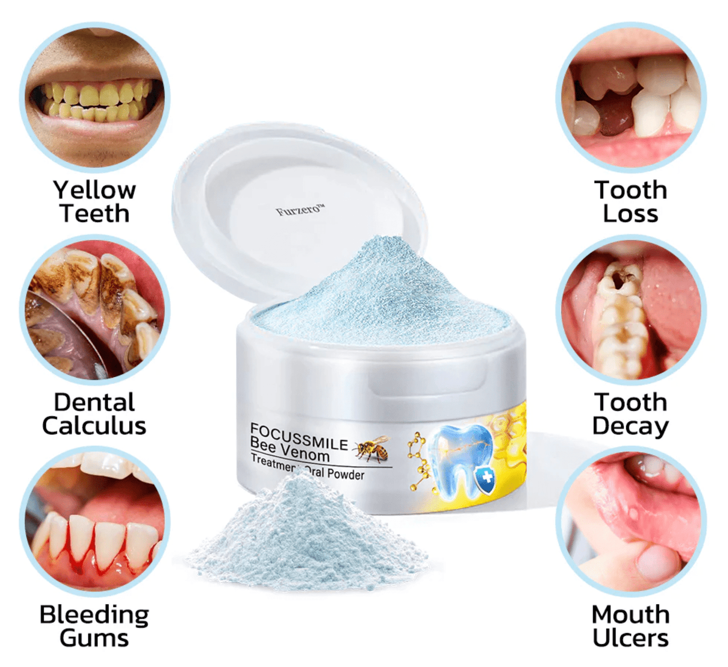 🇺🇸🦷 Furzero™ Focussmile Bee Venom Treatment Oral Powder