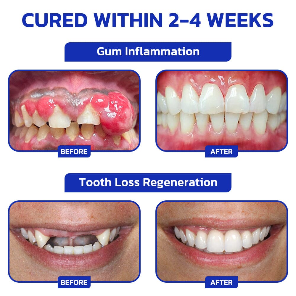 🇺🇸🦷 Furzero™ Focussmile Bee Venom Treatment Oral Powder