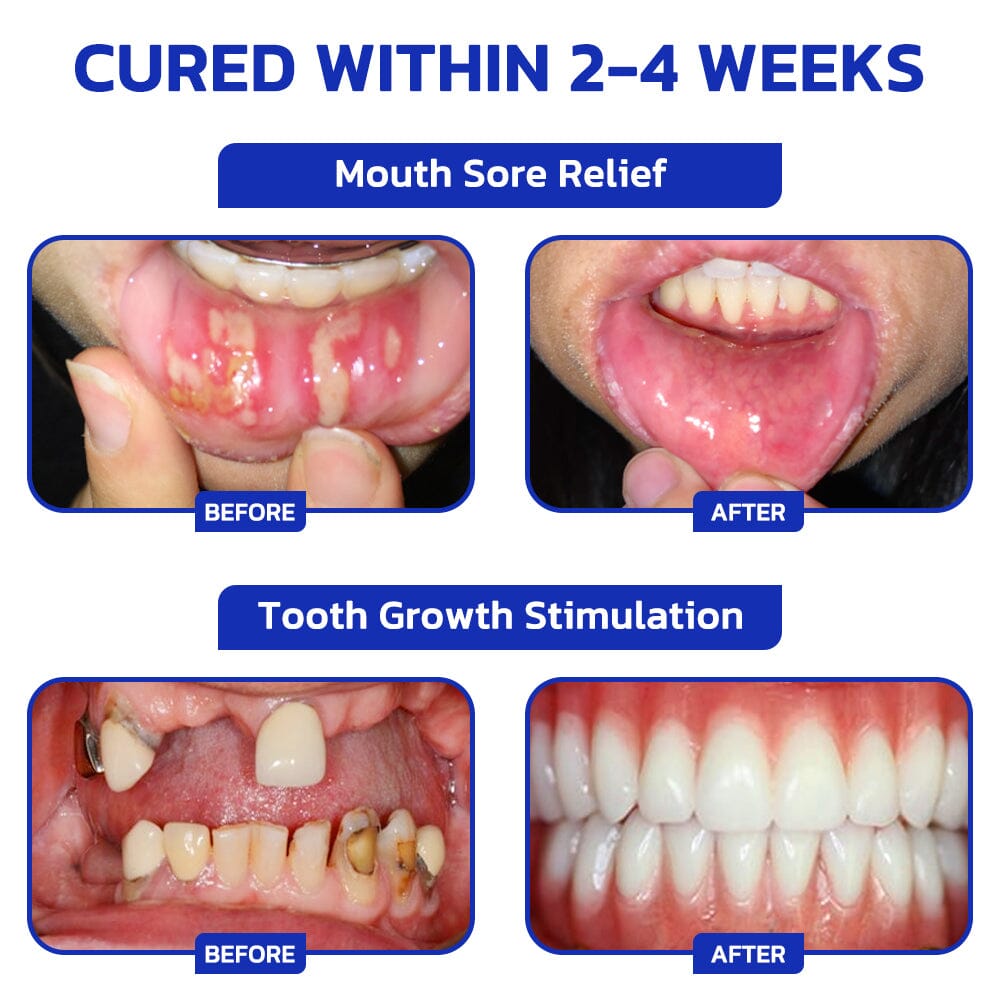🇺🇸🦷 Furzero™ Focussmile Bee Venom Treatment Oral Powder