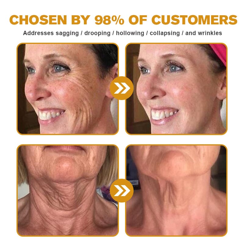 🐝👩⚕️Made and Shipped from USA✨Furzero™ Botox Bee Venom Wrinkle Removal Cream-🔥LAST DAY 70% OFF
