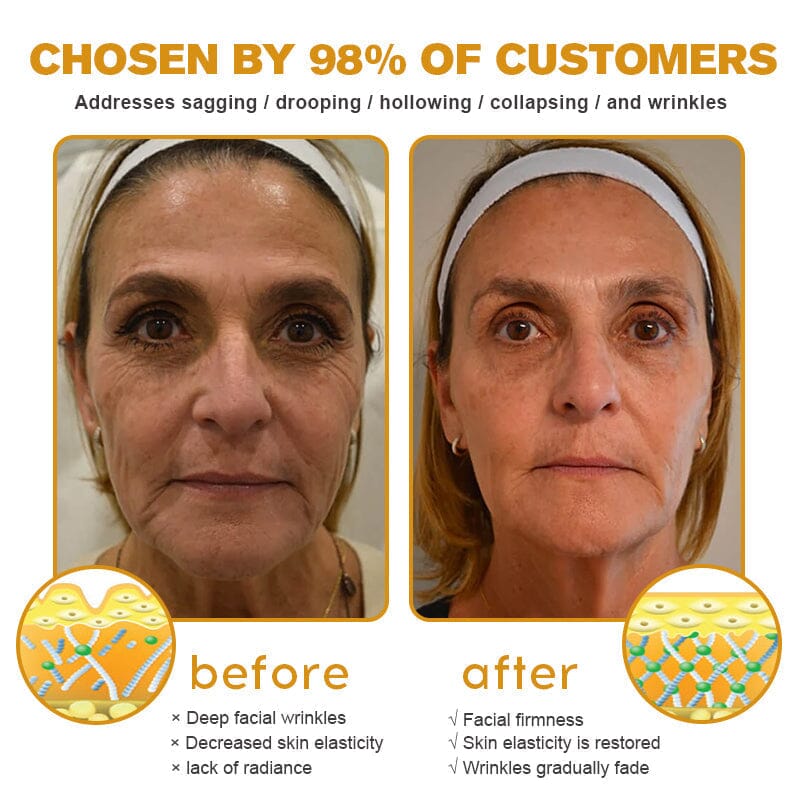 🐝👩⚕️Made and Shipped from USA✨Furzero™ Botox Bee Venom Wrinkle Removal Cream-🔥LAST DAY 70% OFF