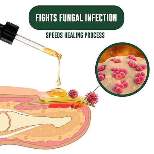 GFOUK™ FullNail Tea Tree Essential Oil