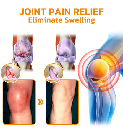 🐝flysmus™ Bee Venom Joint & Bone Recovery Cream（👩🏼‍⚕️Canadian Orthopaedic (COA) recommended, (TPD) certified）