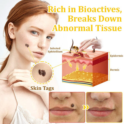 🏆✅flysmus™ Bee Venom Treatment Cream🐝: Helps with Eczema, Psoriasis, Acne, Rosacea, Fungal Infections, and Warts
