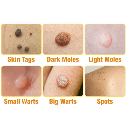 flysmus™ TagRecede-Bee Venom Treatment Spray
