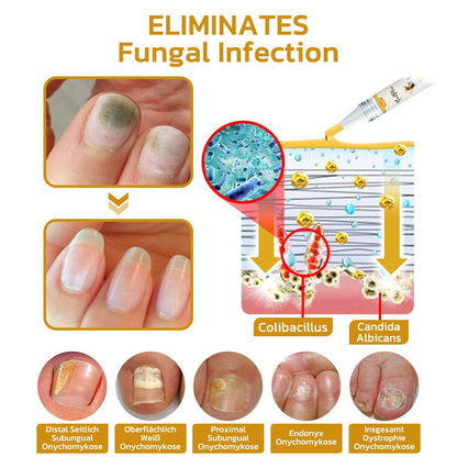 GFOUK™ NailPlus Strong Bee Venom 7 Days Growth Nail Gel