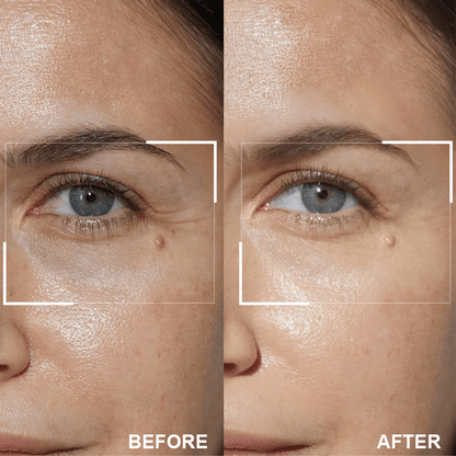 LIMETOW™ Retinol Eye Stick