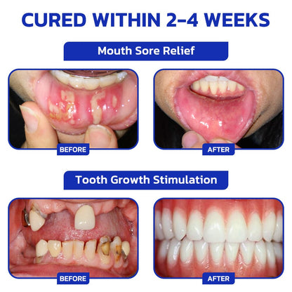 🇺🇸🦷 Furzero™ Focussmile Bee Venom Treatment Oral Powder
