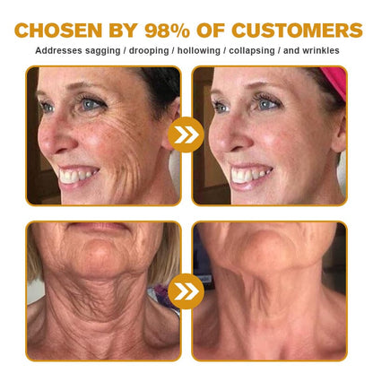 🐝👩‍⚕️Made and Shipped from USA✨Furzero™ Botox Bee Venom Wrinkle Removal Cream-🔥LAST DAY 70% OFF